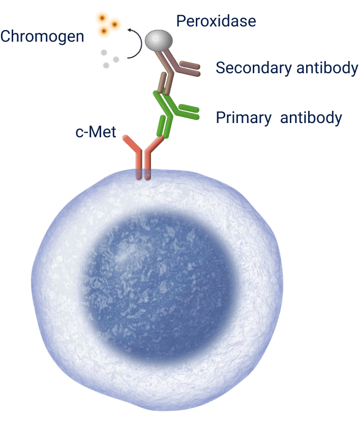 IHC c-Met Protein Overexpression