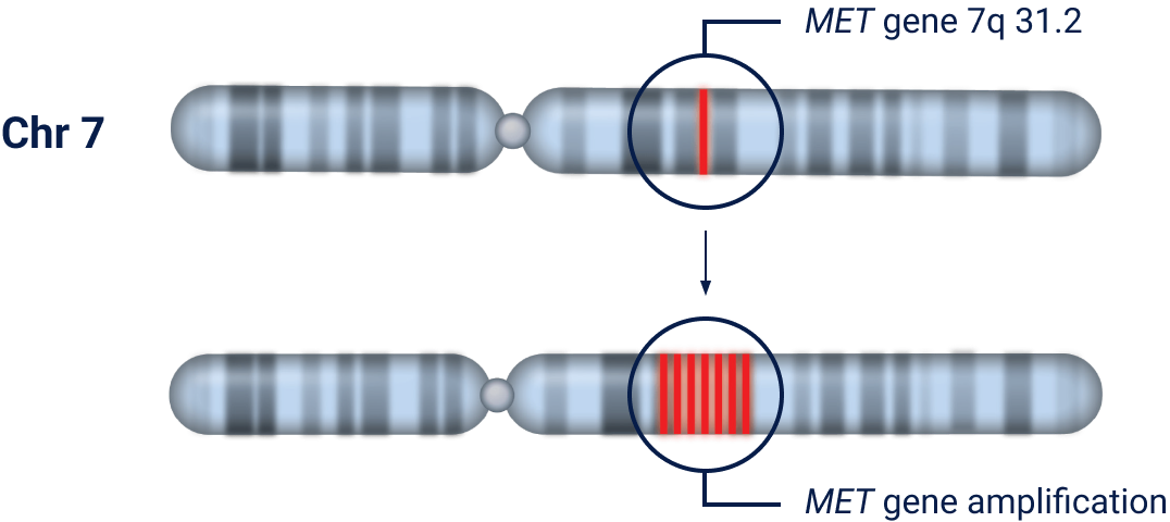 MET Gene Amplification